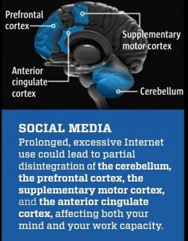 brain-1